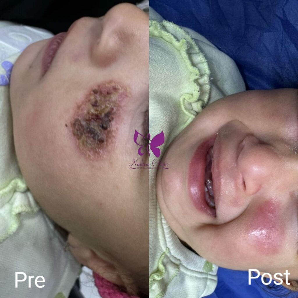 افضل دكتور جلدية اطفال في الغردقة